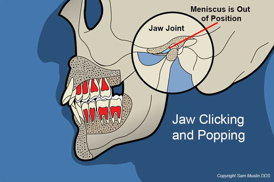 Jaw Moves When Opening Mouth Wide At Zack Housel Blog