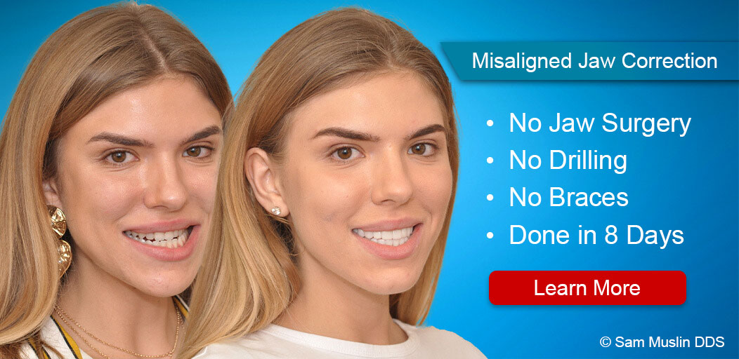 Overbite Correction, No Braces or Invisalign®, No Surgery in 8-Days 